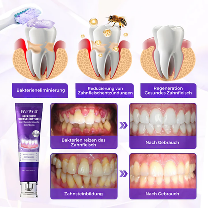 Fivfivgo® BeeRenew Fortschrittlich Zahnfleischheilende Zahnpasta