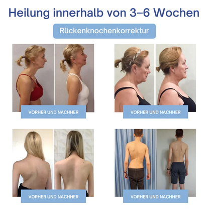 NovaRX® Fortschrittliche Magnesium-Schmerzlinderungscreme