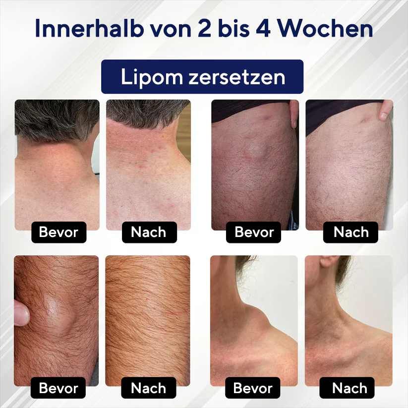 Fivfivgo®  LipoEase Kräuter-Matrix-4-Creme