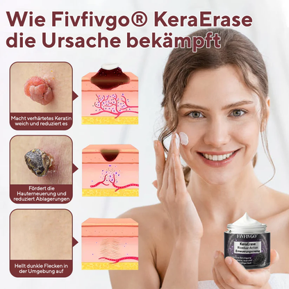 Fivfivgo® KeraErase Ricedual-Action Erneuerungscreme