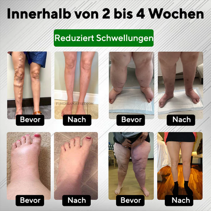 NovaRX® PuffyGone Rosskastanien-Ödemcreme