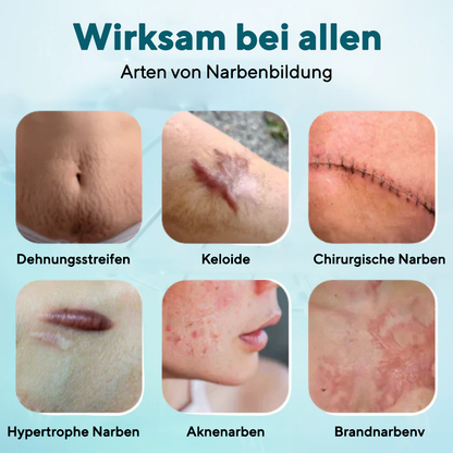 Fivfivgo® Erweiterte Narbengel