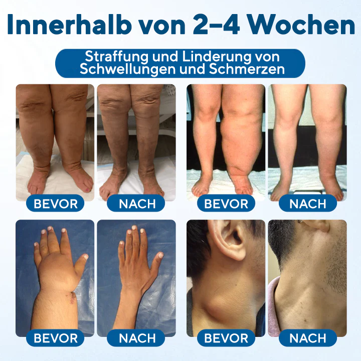 NovaRX® Lymphora Roll-on gegen Schwellungen