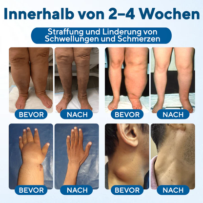 NovaRX® Lymphora Roll-on gegen Schwellungen