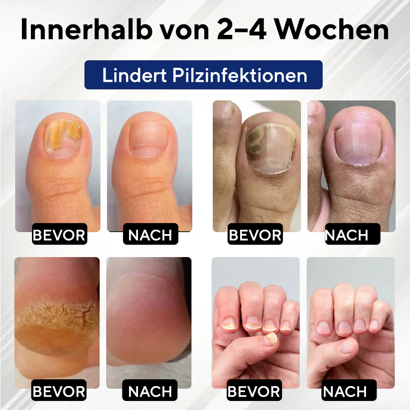 Fivfivgo® FungaGuard Botanica Roll-On-Stick