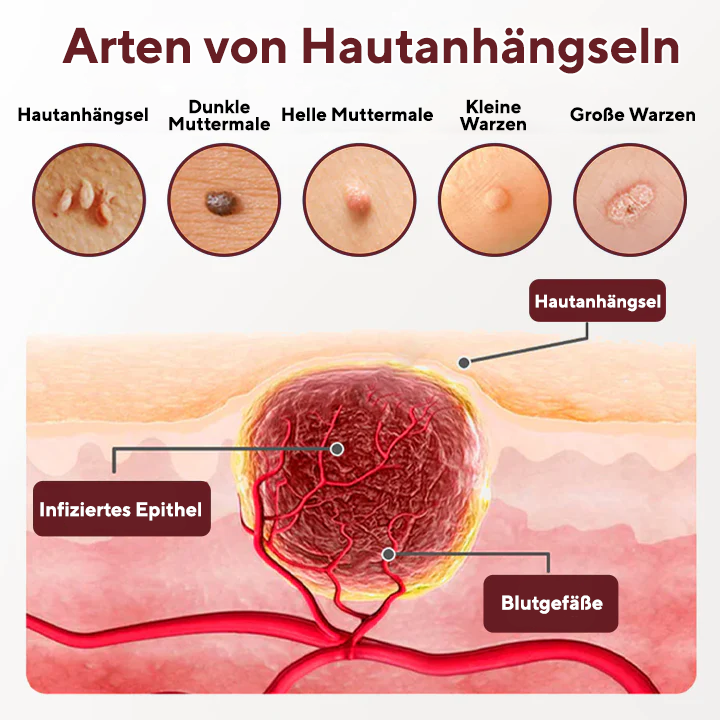Fivfivgo® BumpAway Sanfte Erneuerungscreme
