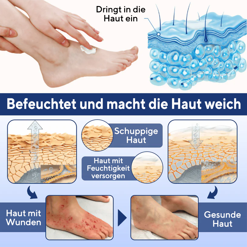 Cvreoz® UltraHeal Fußcreme für Diabetiker