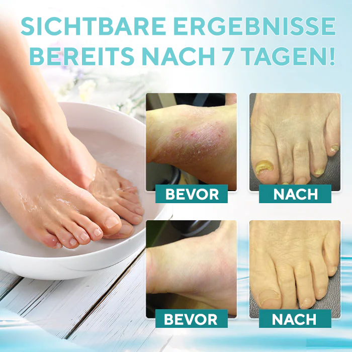 Fivfivgo® ItchBreak Meersalz-Bad