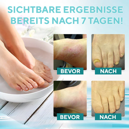 Fivfivgo® ItchBreak Meersalz-Bad