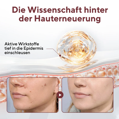 Fivfivgo® KeraErase Ricedual-Action Erneuerungscreme