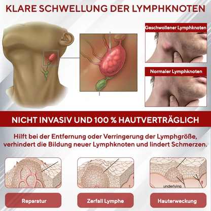 NovaRX® Rotweinstock FluidRelief Ödem-Gel