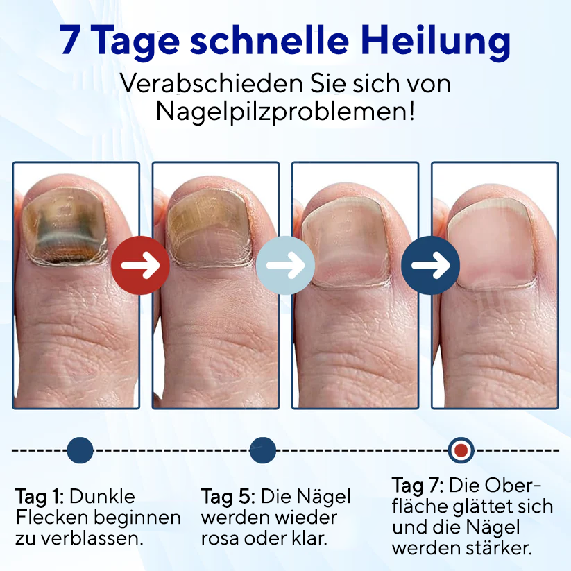 Fivfivgo® MycoShield Pro Nagelpilzpflaster 🏥 Sichtbare Ergebnisse in 2 Tagen + Reparatur in Profiqualität