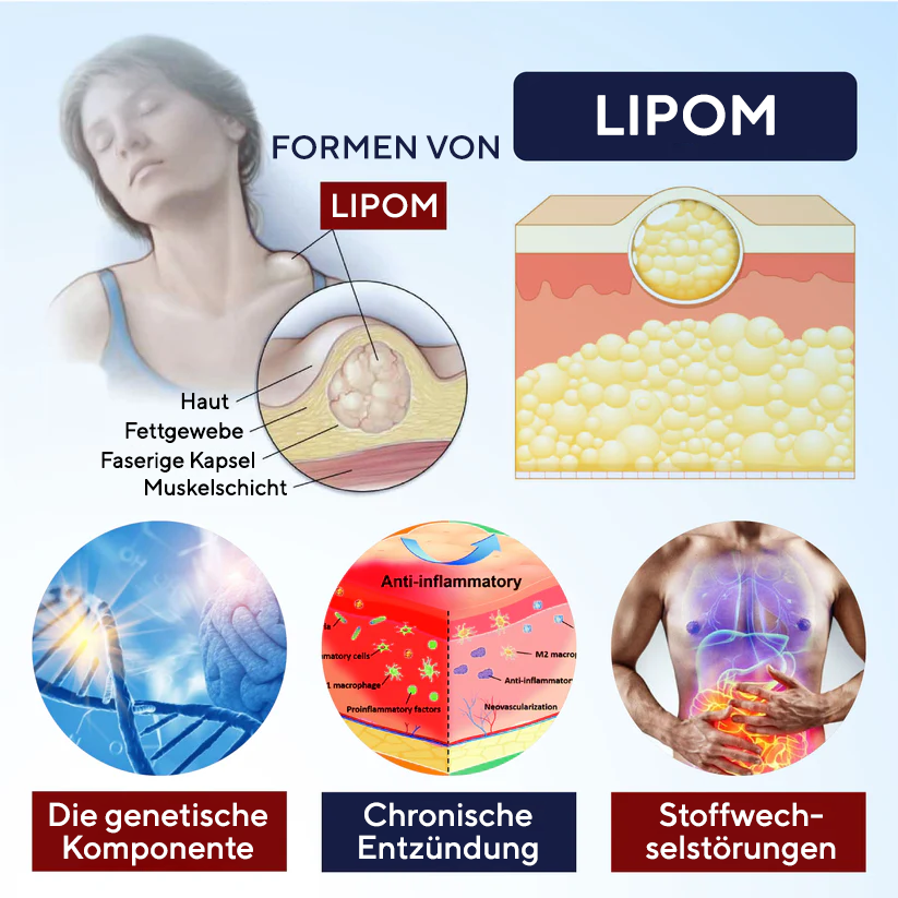 Fivfivgo®  LipoEase Kräuter-Matrix-4-Creme