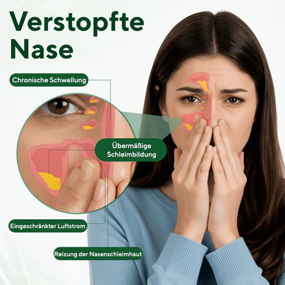 Fivfivgo® RhiniThera Nasenspray
