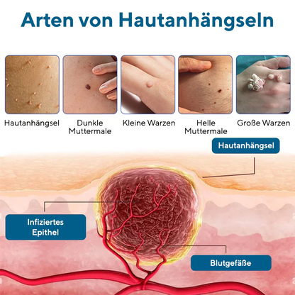 Fivfivgo® DermaVenom RX + Präzisions-Entfernungscreme