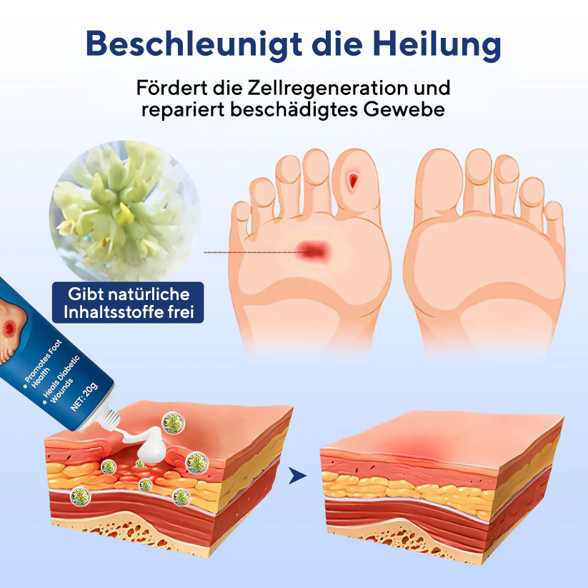 Cvreoz® UltraHeal Fußcreme für Diabetiker