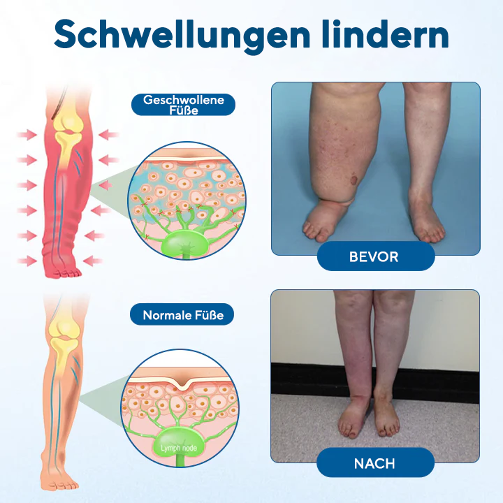 NovaRX® Lymphora Roll-on gegen Schwellungen