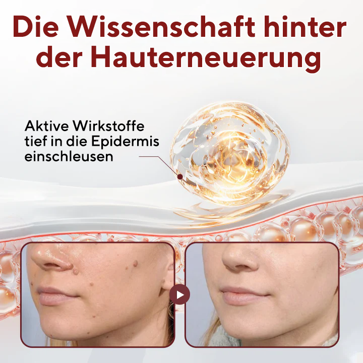 Fivfivgo® BumpAway Sanfte Erneuerungscreme