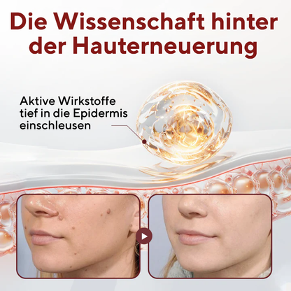 Fivfivgo® BumpAway Sanfte Erneuerungscreme