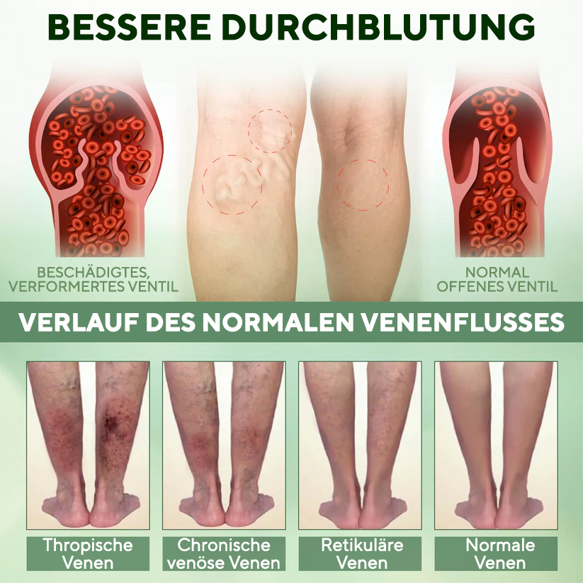 NovaRX® PuffyGone Rosskastanien-Ödemcreme