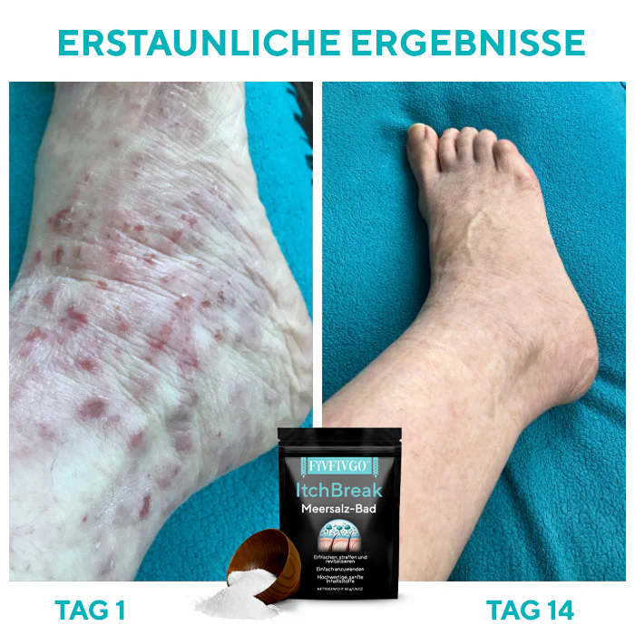 Fivfivgo® ItchBreak Meersalz-Bad