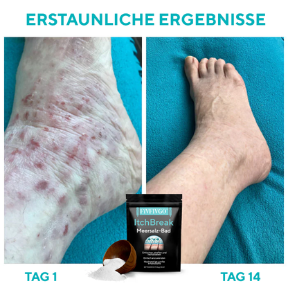 Fivfivgo® ItchBreak Meersalz-Bad