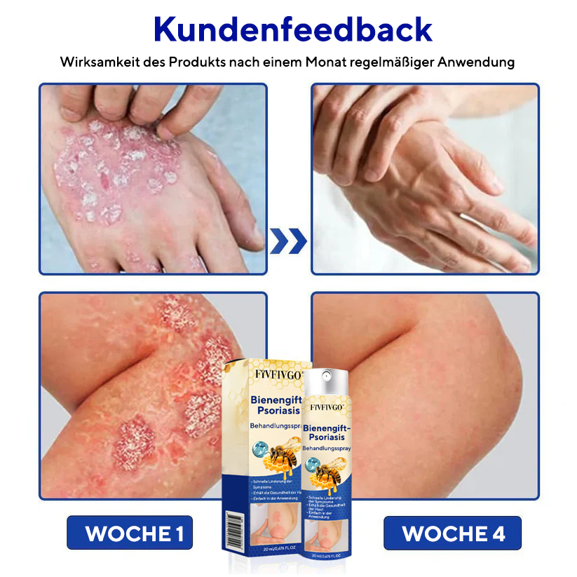 Fivfivgo® Bienengift-Psoriasis-Behandlungsspray