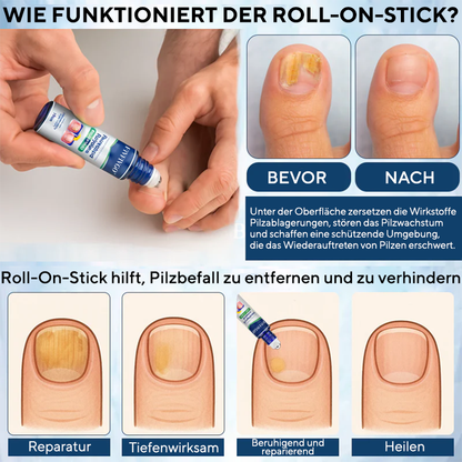 Fivfivgo® FungaGuard Botanica Roll-On-Stick