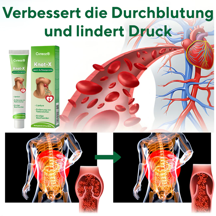 Cvreoz® Knot-X Lipom-Auflösungscreme