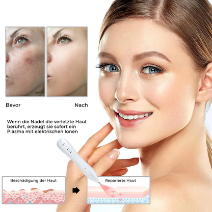 Fivfivgo® Fortschrittlicher Plasma-Laser-Punktreinigungsstift