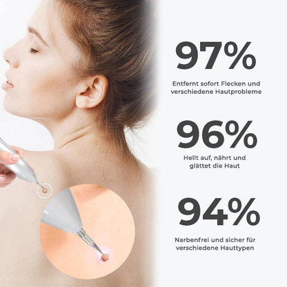 Fivfivgo® Fortschrittlicher Plasma-Laser-Punktreinigungsstift