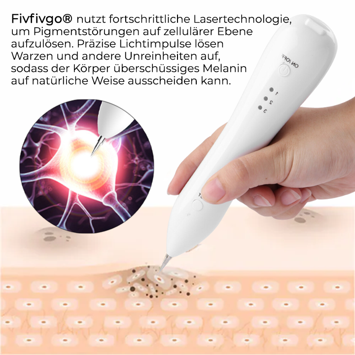 Fivfivgo® Fortschrittlicher Plasma-Laser-Punktreinigungsstift