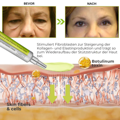 Fivfivgo® Botox & Vita-A Retinol Schuss Falten - Heben Festigende Creme