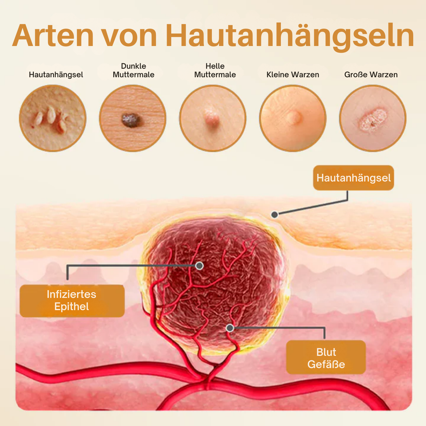 Fivfivgo® Bienen-Gift-Warzen-Erneuerungsspray