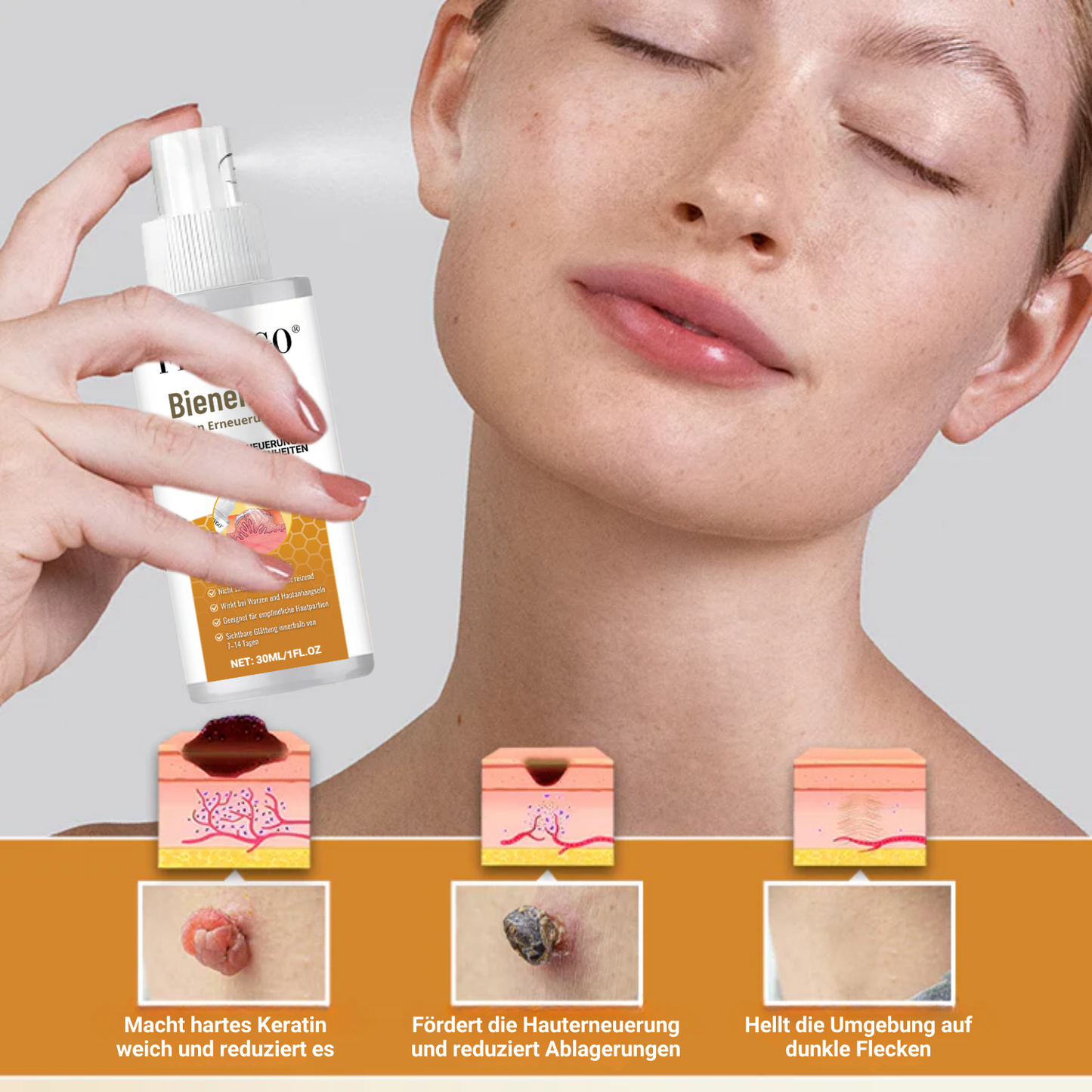 Fivfivgo® Bienen-Gift-Warzen-Erneuerungsspray