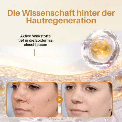 Fivfivgo® Bienen-Gift-Warzen-Erneuerungsspray