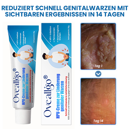 Oveallgo® HPV-Creme zur Linderung genitaler Warzen