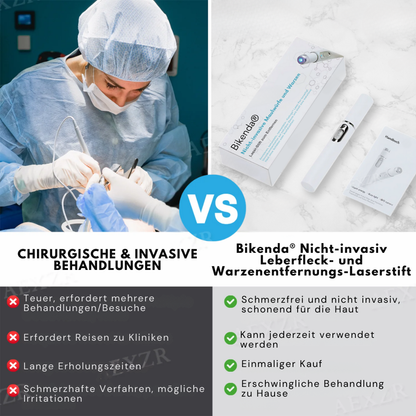 Bikenda® PRO Nicht-invasiv Leberfleck- und Warzenentfernungs-Laserstift