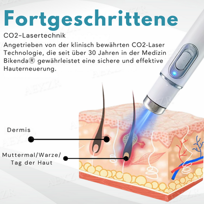 Bikenda® PRO Nicht-invasiv Leberfleck- und Warzenentfernungs-Laserstift
