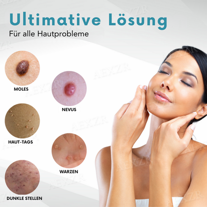 Bikenda® PRO Nicht-invasiv Leberfleck- und Warzenentfernungs-Laserstift